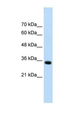 Western Blot: ADAMTS4 Antibody [NBP1-54369]