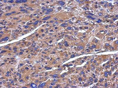 Immunohistochemistry-Paraffin: ADAMTS5 Antibody [NBP2-15286]