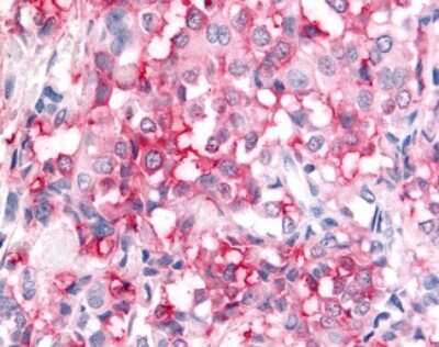Immunohistochemistry-Paraffin: ADAMTS5 Antibody - BSA Free [NLS7761]