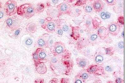 Immunohistochemistry-Paraffin: ADAMTS5 Antibody - BSA Free [NLS7761]