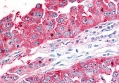 Immunohistochemistry-Paraffin: ADAMTS5 Antibody - BSA Free [NLS7761]