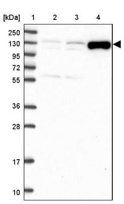 Western Blot: ADAMTS6 Antibody [NBP2-38510]