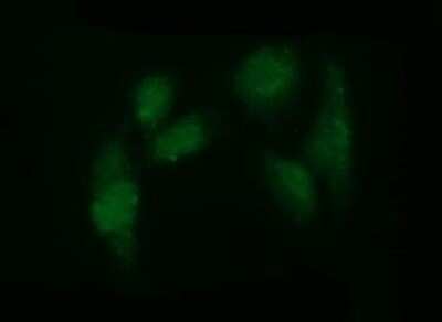 Immunocytochemistry/ Immunofluorescence: ADAMTS8 Antibody (OTI2H5) - Azide and BSA Free [NBP2-71677]