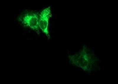 Immunocytochemistry/ Immunofluorescence: ADAMTS8 Antibody (OTI2H5) [NBP2-46494]