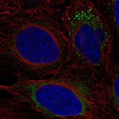 Immunocytochemistry/ Immunofluorescence: ADAMTS9 Antibody [NBP2-55347]