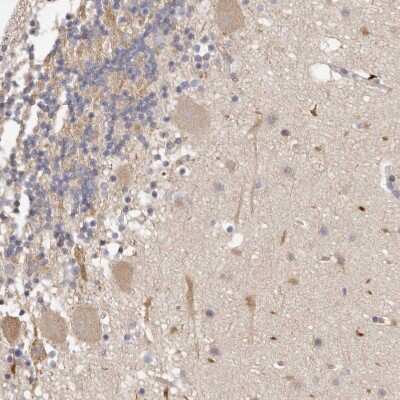 Immunohistochemistry-Paraffin: ADAMTS9 Antibody [NBP1-82915]