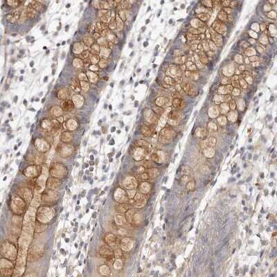 Immunohistochemistry-Paraffin: ADAMTS9 Antibody [NBP1-82915]
