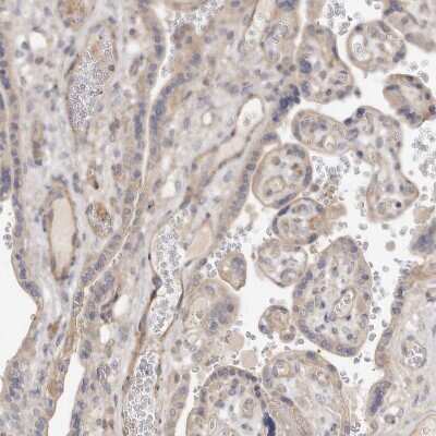 Immunohistochemistry-Paraffin: ADAMTS9 Antibody [NBP1-82915]