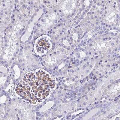 Immunohistochemistry-Paraffin: ADAMTSL2 Antibody [NBP2-14798]