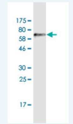 Western Blot: ADAMTSL4 Antibody (2H7) [H00054507-M03]