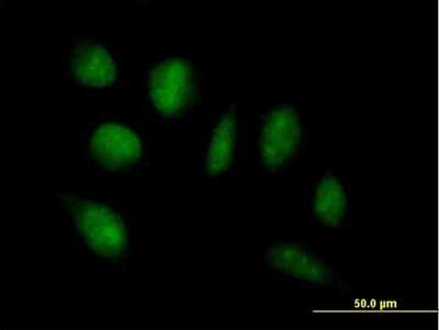 Immunocytochemistry/ Immunofluorescence: ADAMTSL4 Antibody [H00054507-B01P]