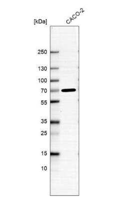 Western Blot: ADAMTSL5 Antibody [NBP1-93438]