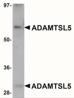 Western Blot: ADAMTSL5 AntibodyBSA Free [NBP2-41120]