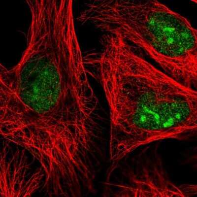Immunocytochemistry/ Immunofluorescence: ADAR Antibody [NBP3-05523]
