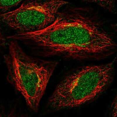 Immunocytochemistry/ Immunofluorescence: ADAT1 Antibody [NBP1-85850]