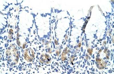Immunohistochemistry-Paraffin: ADAT1 Antibody [NBP1-57221]