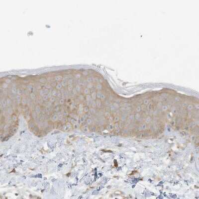 Immunohistochemistry-Paraffin: ADAT2 Antibody [NBP1-84285]