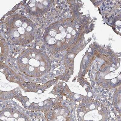 Immunohistochemistry-Paraffin: ADCK1 Antibody [NBP2-14267]