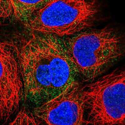 Immunocytochemistry/ Immunofluorescence: ADE2 Antibody [NBP2-58966]