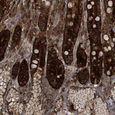 Immunohistochemistry-Paraffin: ADE2 Antibody [NBP1-90235]