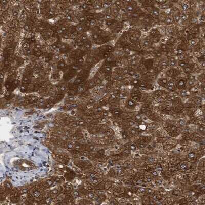 Immunohistochemistry-Paraffin: ADE2 Antibody [NBP1-90235]