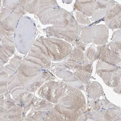 Immunohistochemistry-Paraffin: ADE2 Antibody [NBP1-90235]
