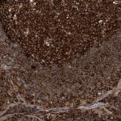 Immunohistochemistry-Paraffin: ADE2 Antibody [NBP1-90235]