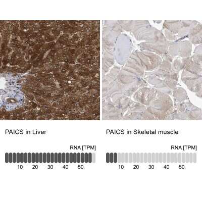 Immunohistochemistry-Paraffin: ADE2 Antibody [NBP1-90235]
