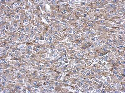 Immunohistochemistry-Paraffin: ADE2 Antibody [NBP2-15290]
