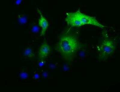 Immunocytochemistry/ Immunofluorescence: ADE2 Antibody (OTI1B4) - Azide and BSA Free [NBP2-71610]