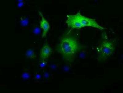 Immunocytochemistry/ Immunofluorescence: ADE2 Antibody (OTI1B4) [NBP2-02817]