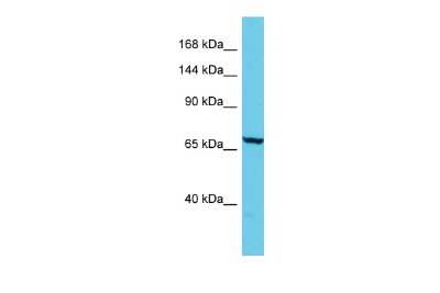 Western Blot: ADGB Antibody [NBP2-82568]