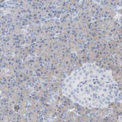 Immunohistochemistry-Paraffin: ADHFE1 Antibody [NBP1-83530]