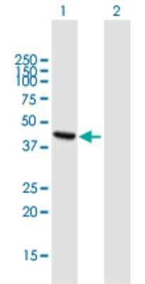 Western Blot: ADHFE1 Antibody [H00137872-B01P]