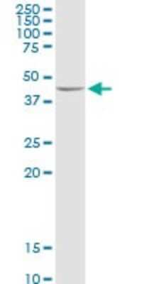 Western Blot: ADHFE1 Antibody [H00137872-D01P]