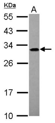 Western Blot: ADHFE1 Antibody [NBP2-15298]