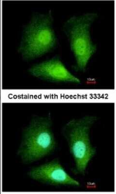 Immunocytochemistry/ Immunofluorescence: ADI1 Antibody [NBP2-15299]