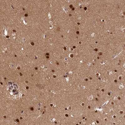 Immunohistochemistry-Paraffin: ADIG Antibody [NBP1-81089]