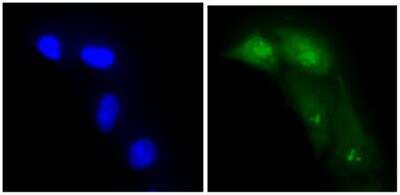 Immunocytochemistry/ Immunofluorescence: ADK Antibody (4F8) - BSA Free [NBP1-97934]