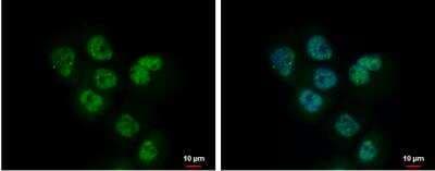 Immunocytochemistry/ Immunofluorescence: ADK Antibody [NBP1-31802]