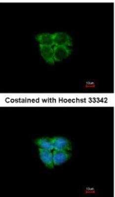 Immunocytochemistry/ Immunofluorescence: ADK Antibody [NBP2-15291]
