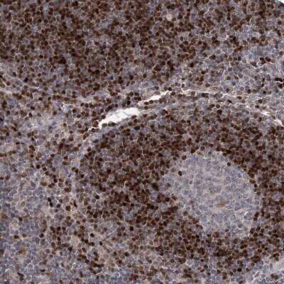 Immunohistochemistry-Paraffin: ADK Antibody [NBP1-90197]