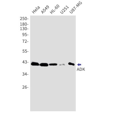 Western Blot: ADK Antibody (S05-0G0) [NBP3-19831]