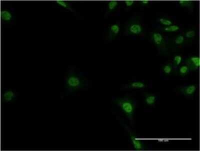 Immunocytochemistry/ Immunofluorescence: ADNP Antibody (2C5) [H00023394-M02]