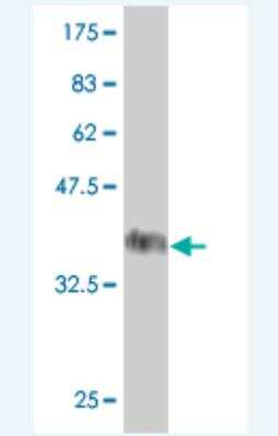 Western Blot: ADNP Antibody (6B8) [H00023394-M01]