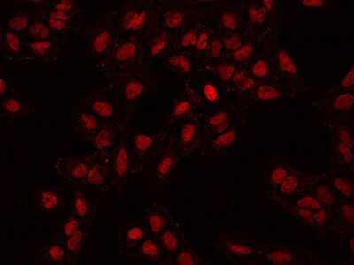 Immunocytochemistry/ Immunofluorescence: ADNP Antibody [NBP2-97747]