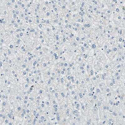 Immunohistochemistry-Paraffin: ADNP Antibody [NBP1-89236]