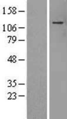 Western Blot: ADNP Overexpression Lysate [NBP2-10045]