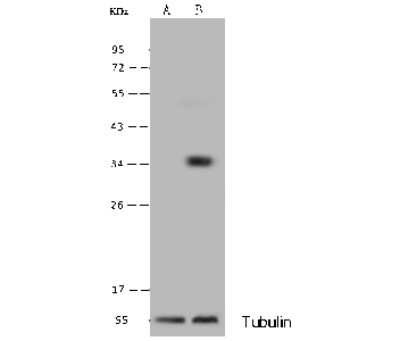 Western Blot: ADP-Sugar Pyrophosphatase/NUDT5 Antibody [NBP3-00064]