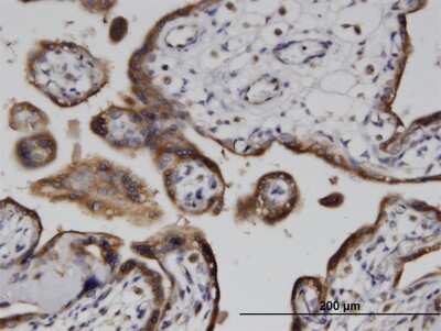 Immunohistochemistry-Paraffin: ADP-ribosylarginine hydrolase Antibody (1F11) [H00000141-M04]